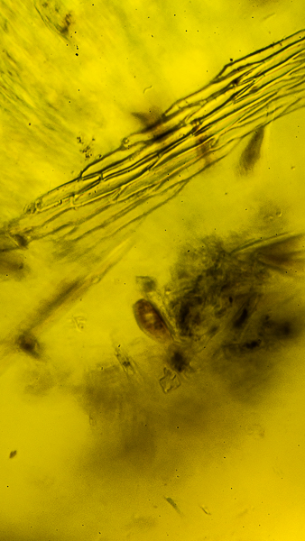 microscopic pond scum